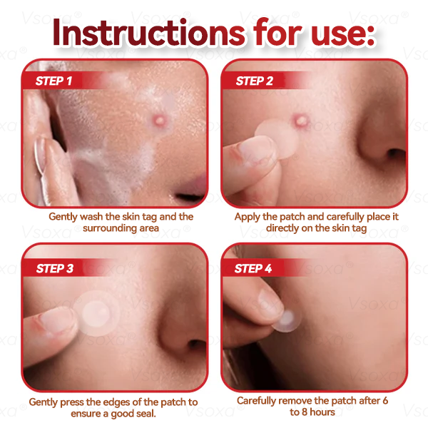 ๐๐ ๐๐ฅ๐ยฎ ๐งMicroneedles Botanical Skin Tags Solution Patches - Made in the USA๐ฉโโ๏ธ