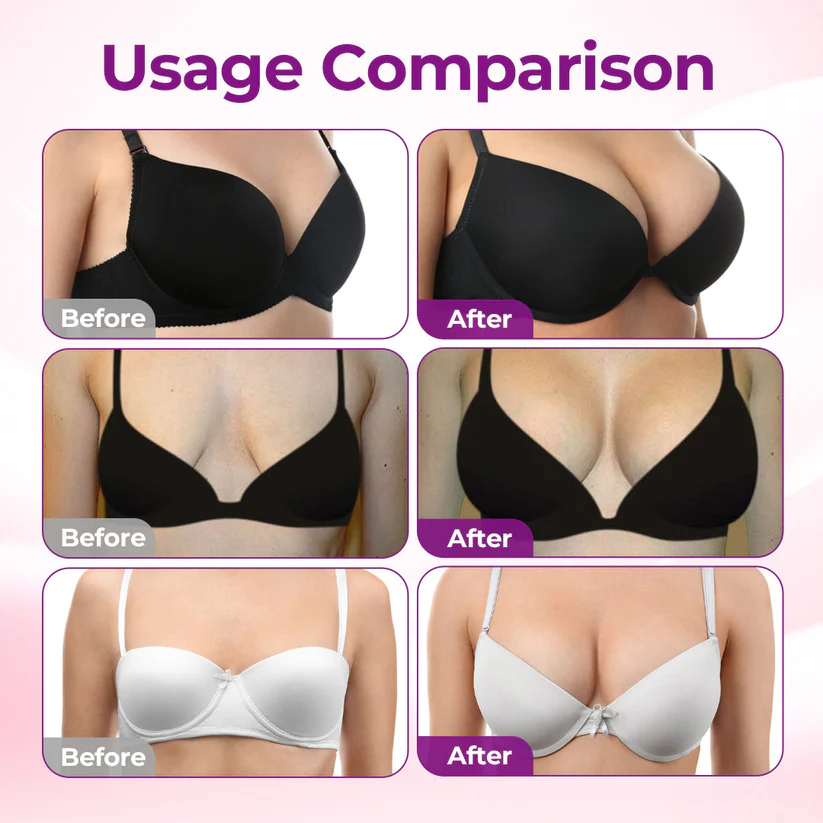 💥Alcuras® 💥Targeted Breast Enhancement Advanced Nano Microneedle Patch💥💥💥